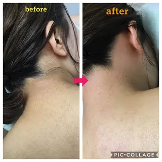 毛穴レス ハーブ& ワックス脱毛×光脱毛のエステ・リラクイメージ