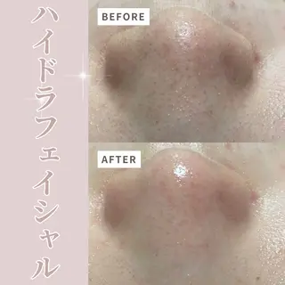 プライベートサロン Belle(ベル)のエステ・リラクイメージ