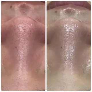 産後/ツヤ肌/子連れ /保育士在籍サロンのエステ・リラクイメージ