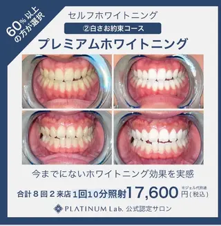 メンズ キッズ ネイル マツエク・マツパ アイブロウ プラチナムビューティー柏所属・【歯科提携】柏ホワイ トニングスタイルのその他イメージ