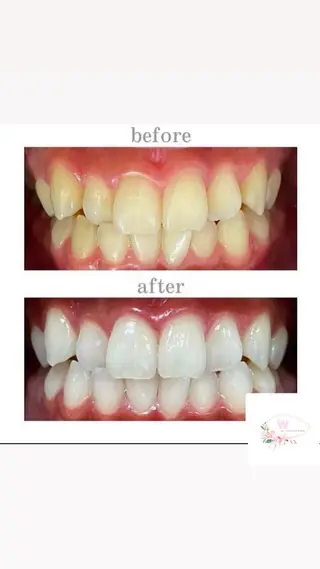 ホワイトニングショップ本厚木所属・ホワイトニング ショップ本厚木のその他イメージ