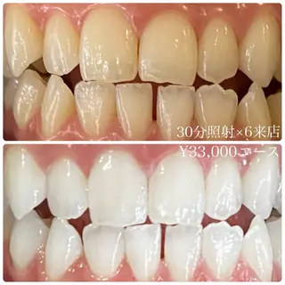 メンズ ホワイトニングルーム 川崎店所属・ホワイトニング ルーム 川崎店のその他イメージ