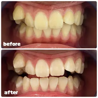 White Berry SELF BEAUTY SALON所属・セルフホワイトニング 🦷口元垢抜け✨のその他イメージ