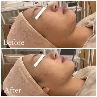 ✨美肌水光✨ アトリエリュバンのエステ・リラクイメージ