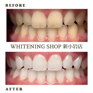 メンズ ホワイトニング ショップ新小岩店のその他イメージ