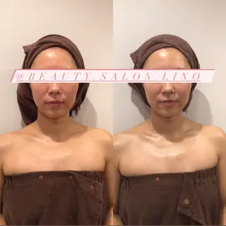 痩身×フェイシャル ブライダル|Linoのエステ・リラクイメージ