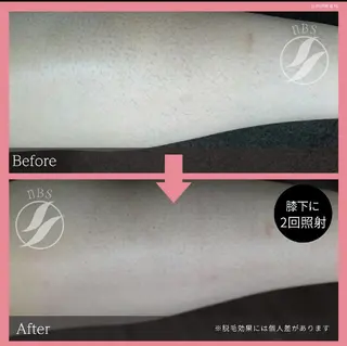 beauty salon by BMbm所属・名倉 彩乃のエステ・リラクイメージ