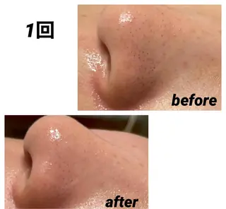 DeI'm   名古屋栄所属・小林 玲菜のエステ・リラクイメージ