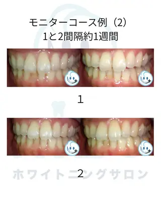 ホワイトニングサロン nico西葛西店のその他イメージ