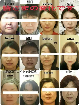 小顔と美肌 まごころエステMatoria所属・小顔 美肌専門 Matoriaのエステ・リラクイメージ