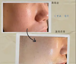 代表 MOMOの眉毛・アイブロウイメージ