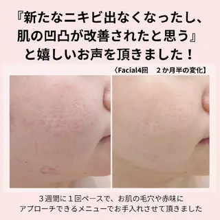 PRETTIEST SHINE所属・山田 浩子のエステ・リラクイメージ