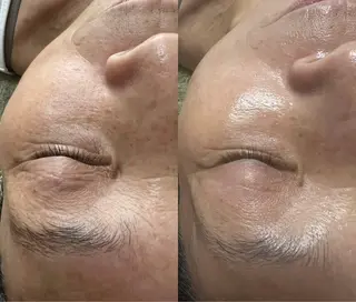 Beauty Salon Adiy所属・Adiy ikumiのエステ・リラクイメージ