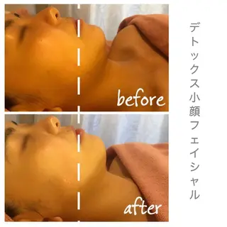 シミケアサロン REVIASオーナーのエステ・リラクイメージ