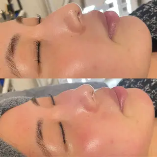 yume   eyelash所属・yumeka 【eyelash】のマツエク・マツパデザイン