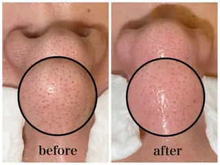 マツエク・マツパ 韓国肌管理 【毛穴専科】のエステ・リラクイメージ