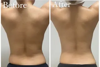 beautysalon RAVIS所属・東大阪/韓国肌管理/ 痩身バスト専門店のエステ・リラクイメージ