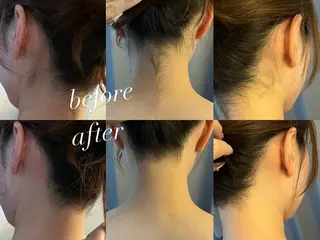 うなじ脱毛/美肌脱毛 LABELのエステ・リラクイメージ