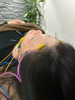 美容鍼灸整体サロンBeauJu所属・小顔矯/美容鍼/鍼灸 BeauJuのその他イメージ