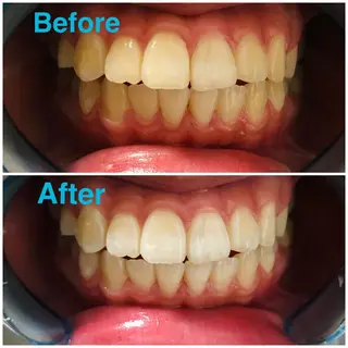 イーチブライト EachBrightのその他イメージ