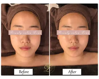 痩身×フェイシャル ブライダル|Linoのエステ・リラクイメージ