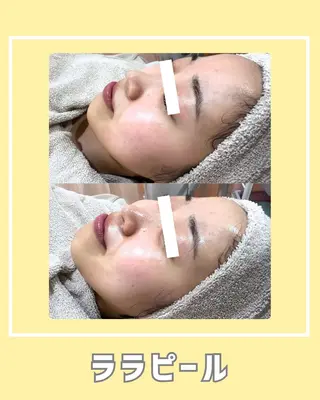 s o i n a🤍🪽ララピール/毛穴/小顔/水光肌所属・s o i n a 神楽坂のエステ・リラクイメージ