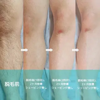 プライベートサロンBRAG所属・プライベートサロン BRAG🏠男女OKのエステ・リラクイメージ