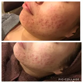 ロング カラー パーマ ヘアアレンジ メンズ キッズ ネイル マツエク・マツパ 四つ星サロン🎖 腸＆ニキビケアに特化のエステ・リラクイメージ