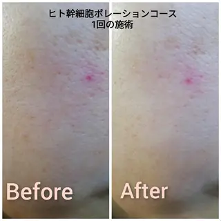 エステサロン Lazulisea所属・川口 春奈のエステ・リラクイメージ