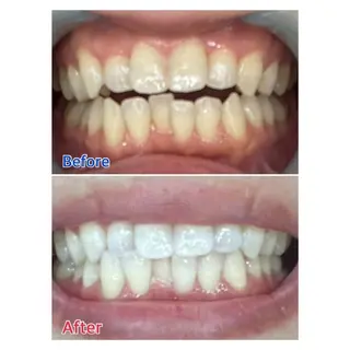 MBEAUTYSALON 千葉店・京成大久保所属・Melty 輝のその他イメージ