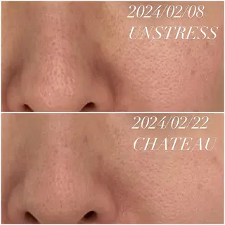 肌質改善|天王寺 For...はるかのエステ・リラクイメージ