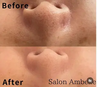 サロン Ambelle所属・北川 亜友美のエステ・リラクイメージ