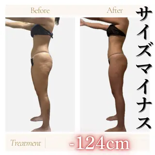 京橋 痩身エステ専門サロン BOSS  BODY所属・京橋痩身エステ専門サ ロンBOSSBODYのエステ・リラクイメージ
