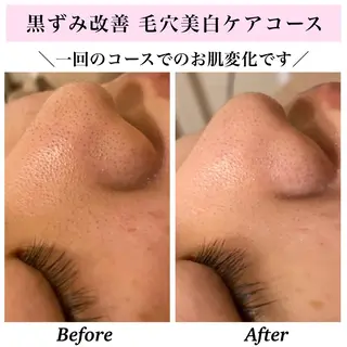 Bellesthe (ベルエステ)のエステ・リラクイメージ