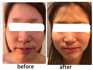 アクシア ビューティー サロン所属・究極のアンチエイ ジングサロンのエステ・リラクイメージ