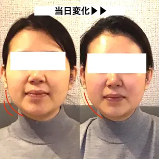 顔の歪み矯正専門 宮内翔のエステ・リラクイメージ