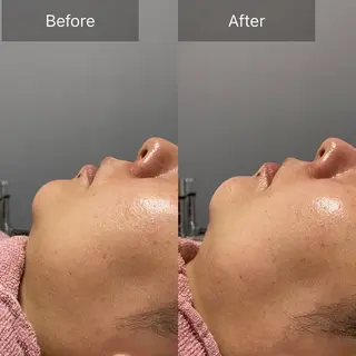 ALIA Scintiller  アリアサンティエ所属・齋藤 祐里耶のエステ・リラクイメージ