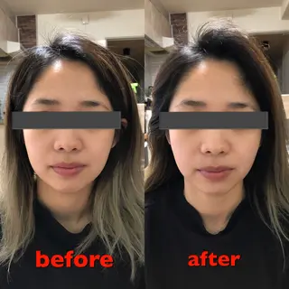 小顔・ツルツル素肌 ハリステリアのエステ・リラクイメージ