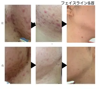 KalanDiva〜 カランディーバ〜のエステ・リラクイメージ