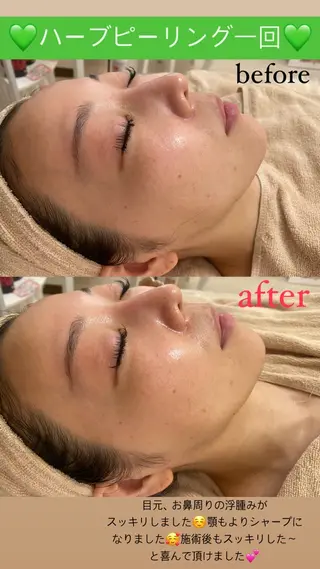 Salon de Lino 御器所のエステ・リラクイメージ