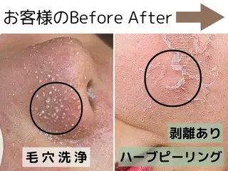 【肌質改善サロン】 医療提携シャルムのエステ・リラクイメージ