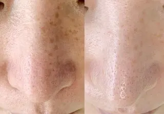 メンズ salonLADYSTYLE所属・稲嶺 美華のエステ・リラクイメージ