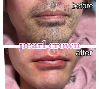 pearl crown所属・pearlcrown 博多Wax＆光脱毛のその他イメージ