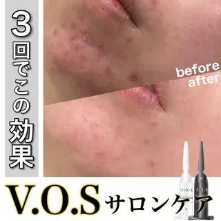 laluna saki...のその他イメージ