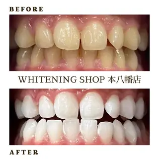 メンズ ホワイトニング ショップ本八幡店のエステ・リラクイメージ