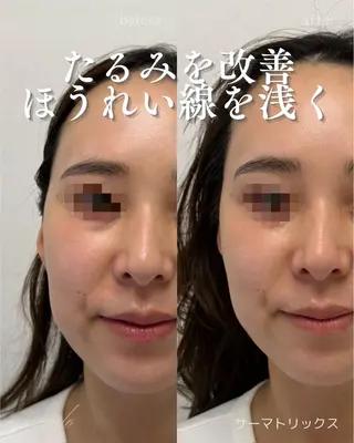 肌質改善フェイシャル 看護師 只野のエステ・リラクイメージ