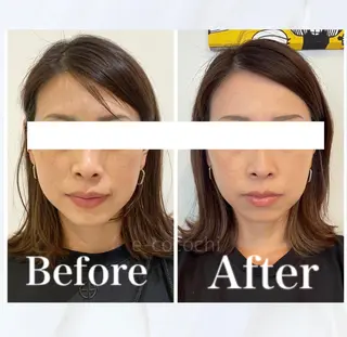 小顔と ヘッドスパのお店のエステ・リラクイメージ