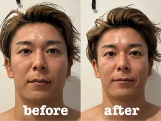 美容鍼灸Solana所属・小櫻 唯のエステ・リラクイメージ