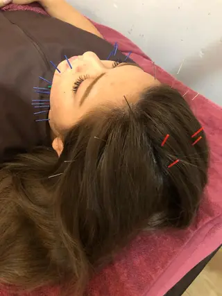 美容鍼灸女性専用 りんご鍼灸治療院のその他イメージ