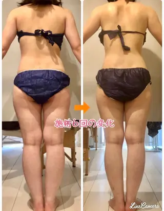 ショート カラー パーマ ヘアアレンジ メンズ キッズ ネイル マツエク・マツパ 痩身&ボディ 結果出し🌟丹野のエステ・リラクイメージ